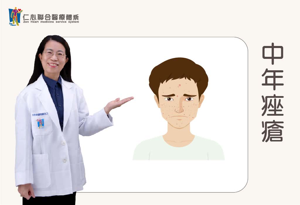 中年痤疮